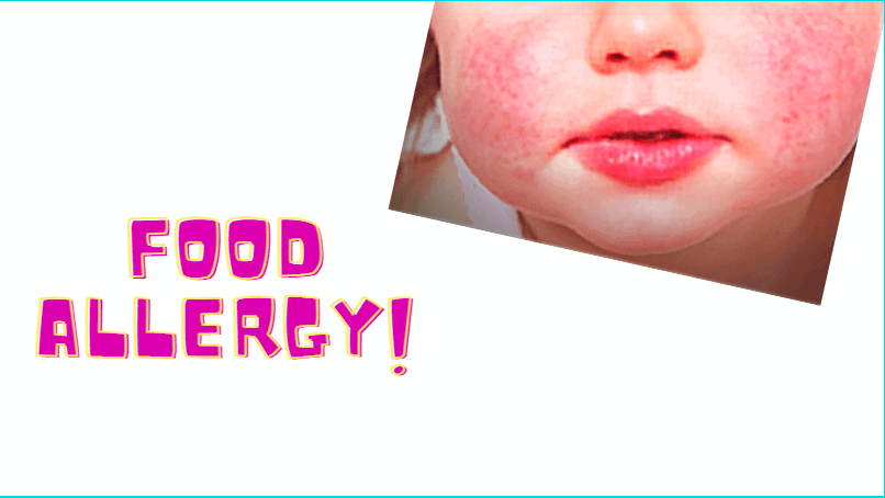 food allergy in baby rash