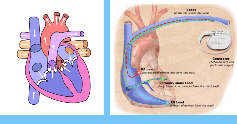 what is coronary sinus