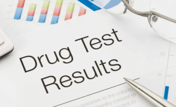 Drug Test and Pre-employment Criteria