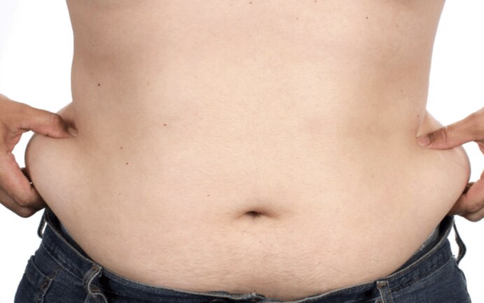 benefits of liposuction