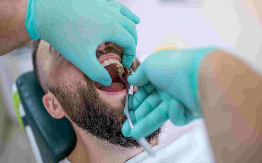How To Prepare For A Tooth Extraction
